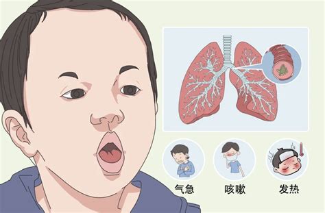 小孩子一直咳嗽|孩子咳嗽老不好，终于找到原因了！这8件事家长一定要做